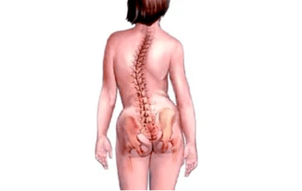 Na cúiseanna le forbairt osteochondrosis ceirbheacs