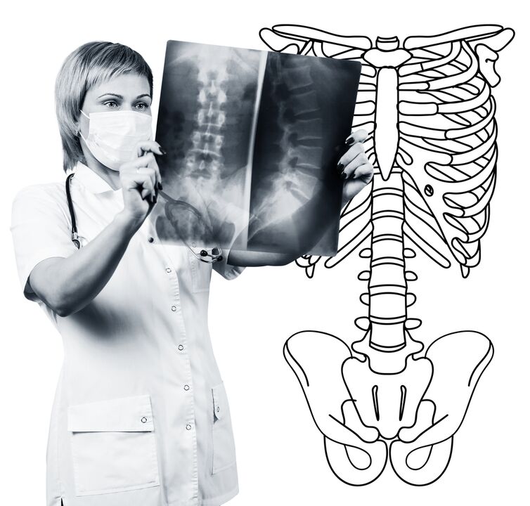 Radagrafaíocht an Spine Lumbar
