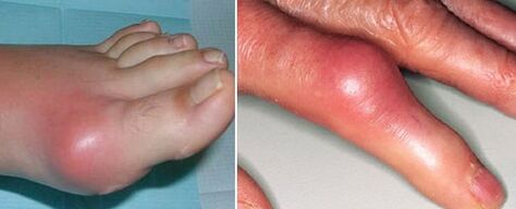 cuma na hailt le airtríteas