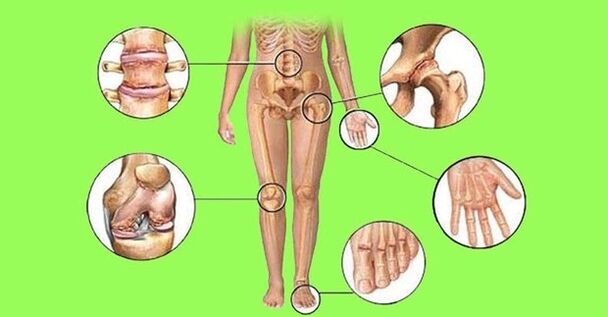 joints tionchar ag airtríteas agus airtróisis