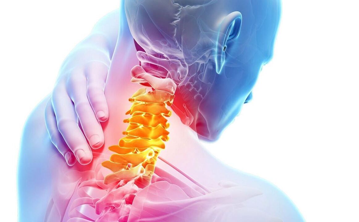 pian le osteochondrosis ceirbheacsach